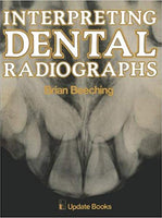 Interpreting Dental Radiographs by B.W. Beeching